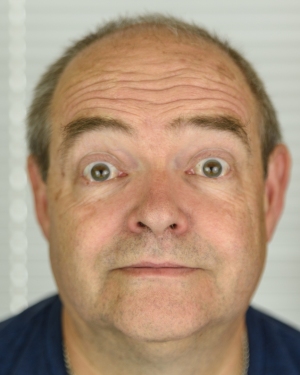 Ralph-Surprised
